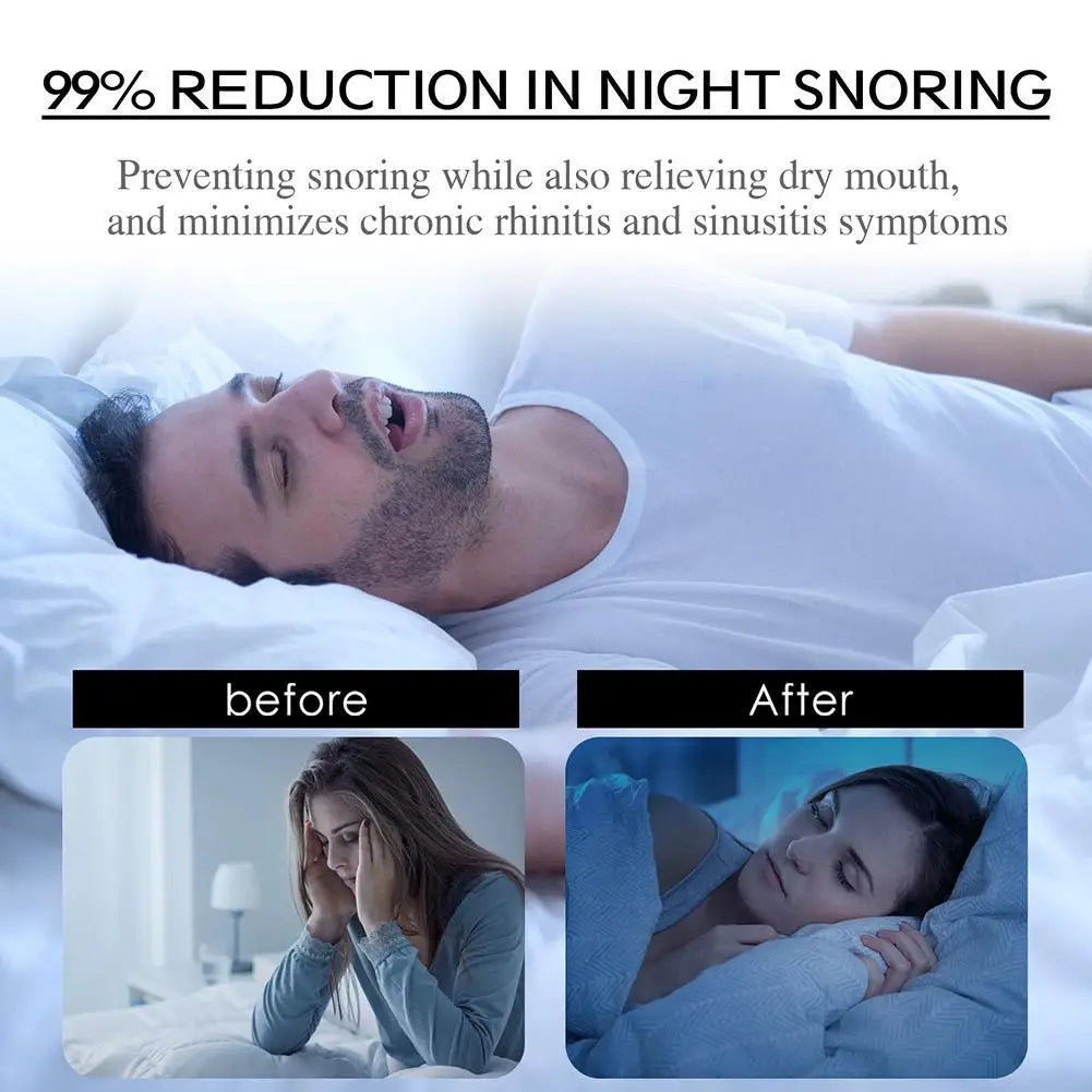 Sleep Improvement Tape (30 Pieces)
